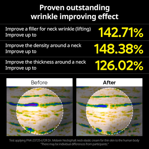 Necksphalt ECM Neck Tightening Line