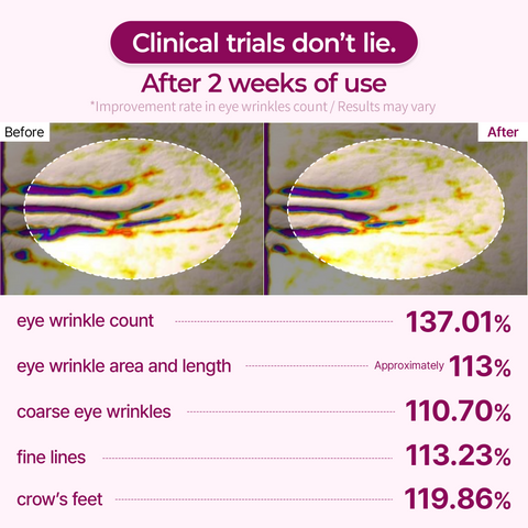 [😮 Under-Eye Hollows & Crow's Feet?] Firm & Brighten in One Patch — Dr.Melaxin Cemenrete Calcium Eye Patch - Dr.Melaxin.us