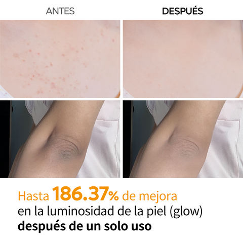 [¿Piel áspera y con textura irregular? ¡Un solo spray!] Peel Shot – Spray Exfoliante Corporal con 99% de Ácido Kójico y Cúrcuma