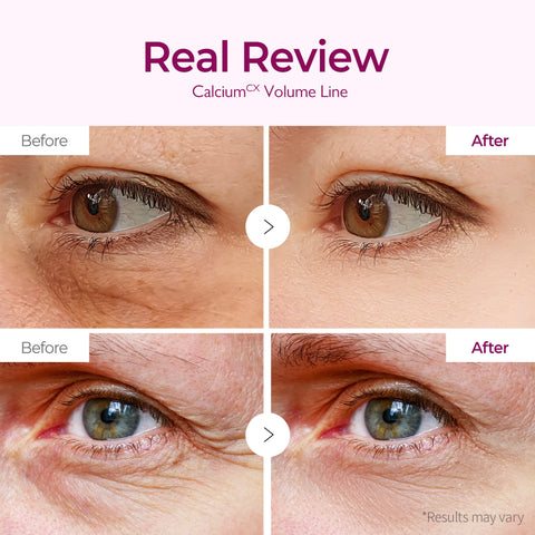 [😮 Under-Eye Hollows & Crow's Feet?] Firm & Brighten in One Patch — Dr.Melaxin Cemenrete Calcium Eye Patch - Dr.Melaxin.us