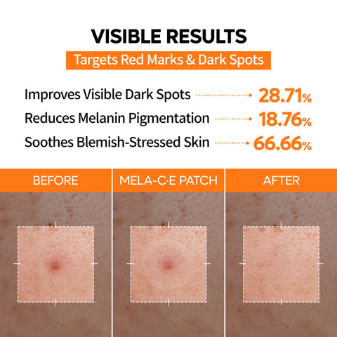 MELA-C·E ZERO FIT Ultra Thin Dark Spot Patch