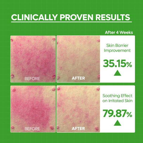 S-ZINC Blemish Cream