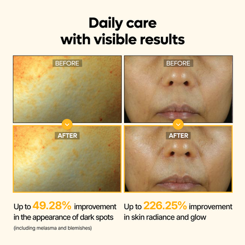 Kojic Acid Turmeric Serum