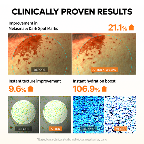 Mela-C·E Ferulic Bubble Toner