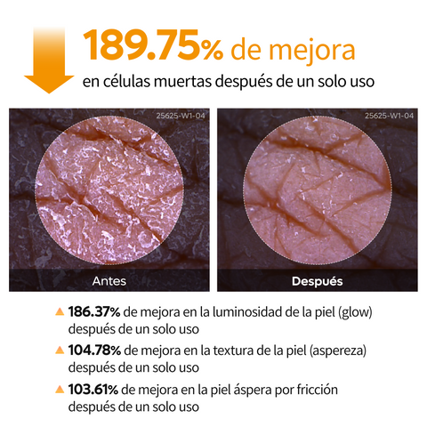 [¿Piel áspera y con textura irregular? ¡Un solo spray!] Peel Shot – Spray Exfoliante Corporal con 99% de Ácido Kójico y Cúrcuma