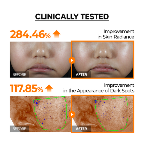 Mela-C·E Ferulic Serum