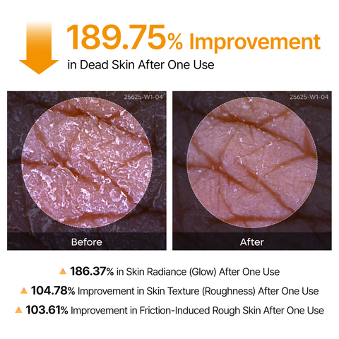 [Bumpy, Rough Skin? One Spray Fixes It] Peel Shot – 99% Kojic Acid x Turmeric Body Peeling Spray