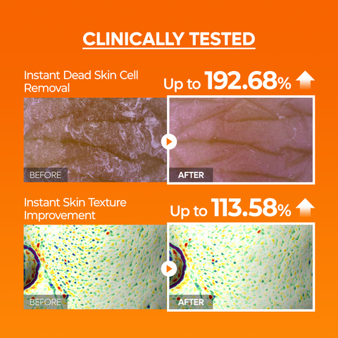 Peel Shot Exfoliating MELA-C·E Ferulic Serum