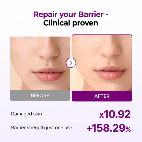 Calcium Bonding Barrier Repair Toner