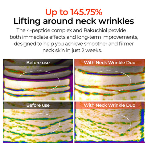 3-Minute Neck Wrinkle Care Trio