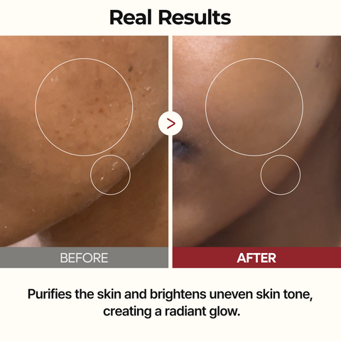 Peel Shot Glow Rice Toner