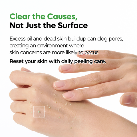 PEEL SHOT Exfoliating S-ZINC Blemish Serum