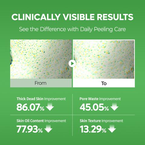 PEEL SHOT Exfoliating S-ZINC Blemish Serum