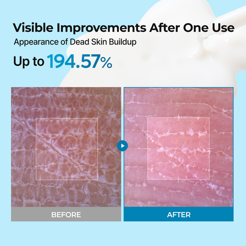 Peel Shot Exfoliating TX-Serum