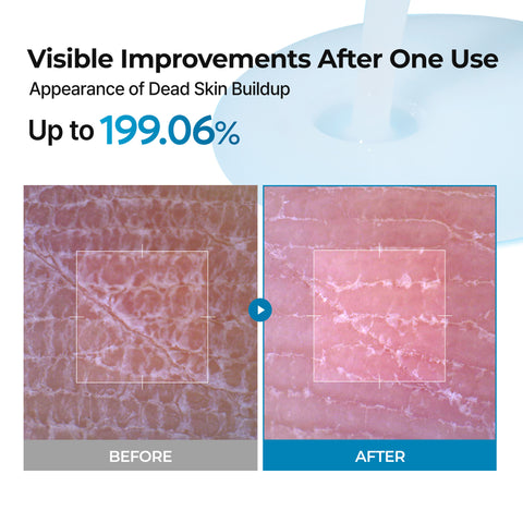 Peel Shot Exfoliating TX-Spray