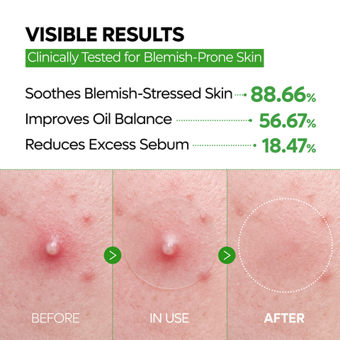 S-ZINC ZERO FIT Ultra Thin Blemish Spot Patch