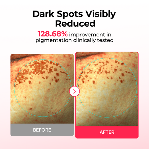 TX Astaxanthin Dark Spot Care Hydrogel Mask 4EA