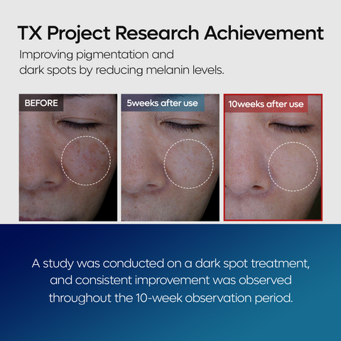 TX Tranexamic Acid Dark Spot Care Line