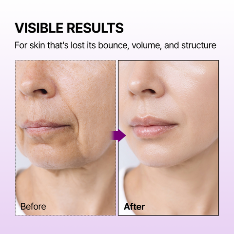 Calcium Bonding Facial Cream