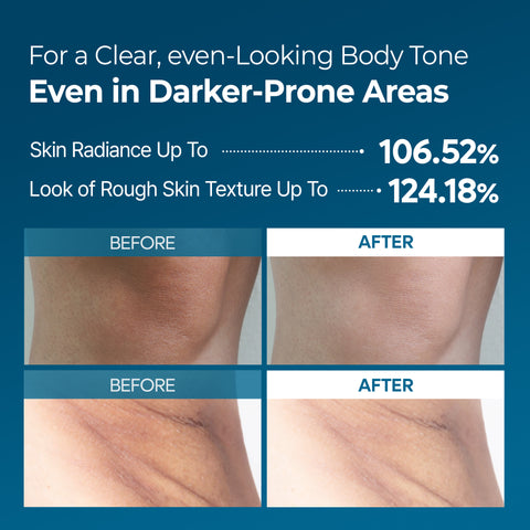 Peel Shot Exfoliating TX Spray